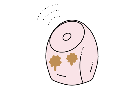 汚れがひどい